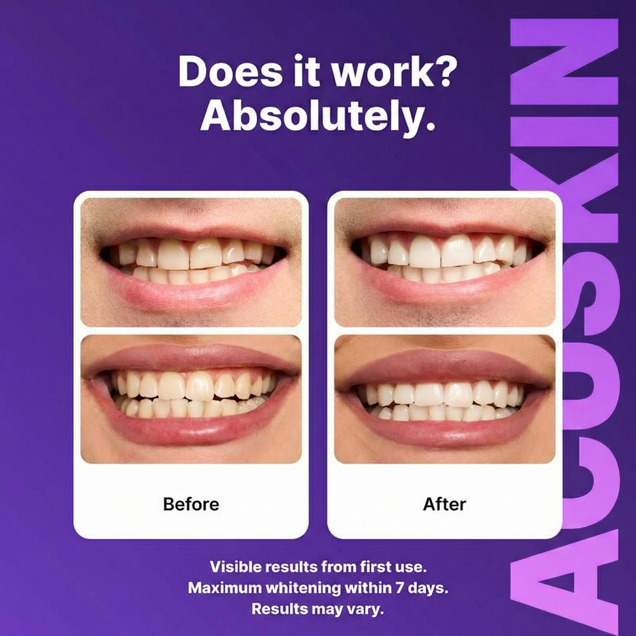 Purple Teeth Whitening Strips
