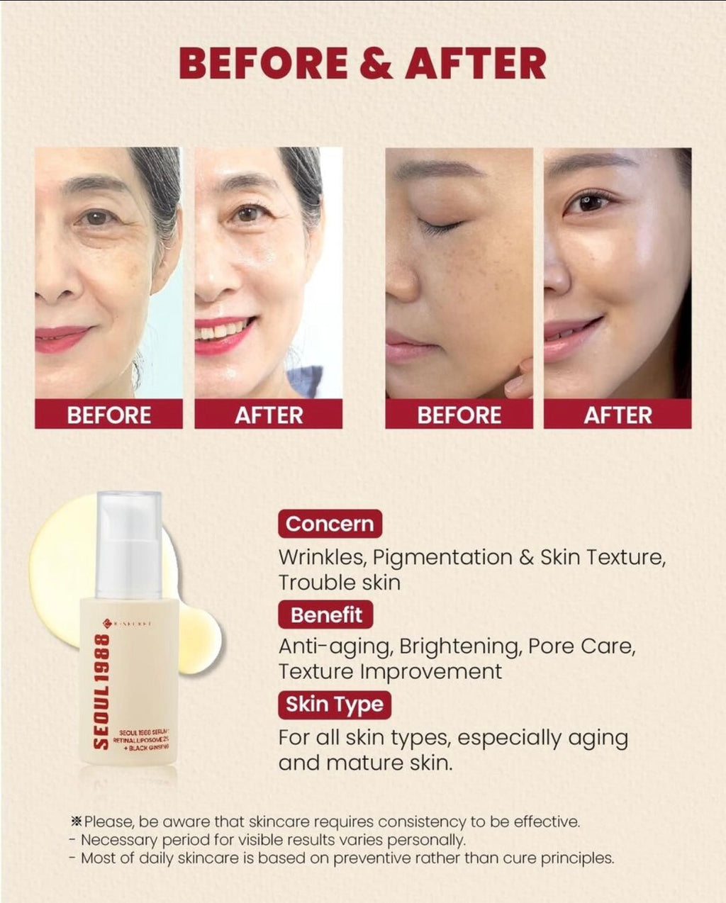 Seoul 1988 Retinol